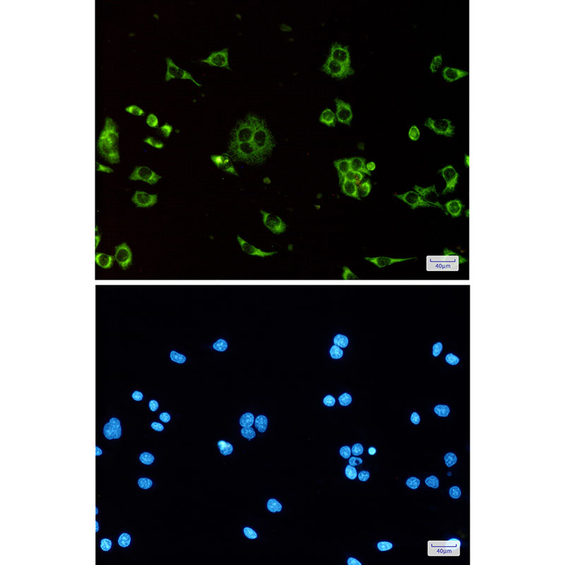ATP Synthase C Rabbit mAb ABZ2770