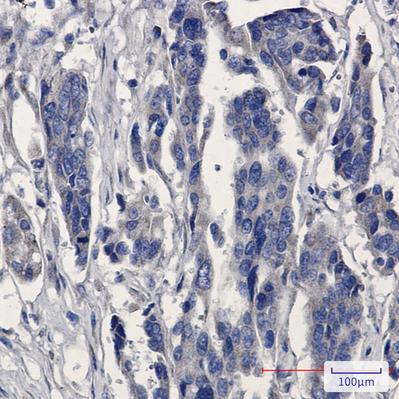 MGST1 Rabbit mAb ABZ2771