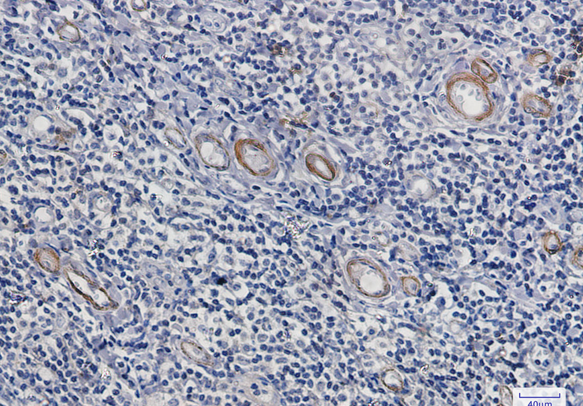 Asparagine Synthetase Rabbit mAb ABZ2774