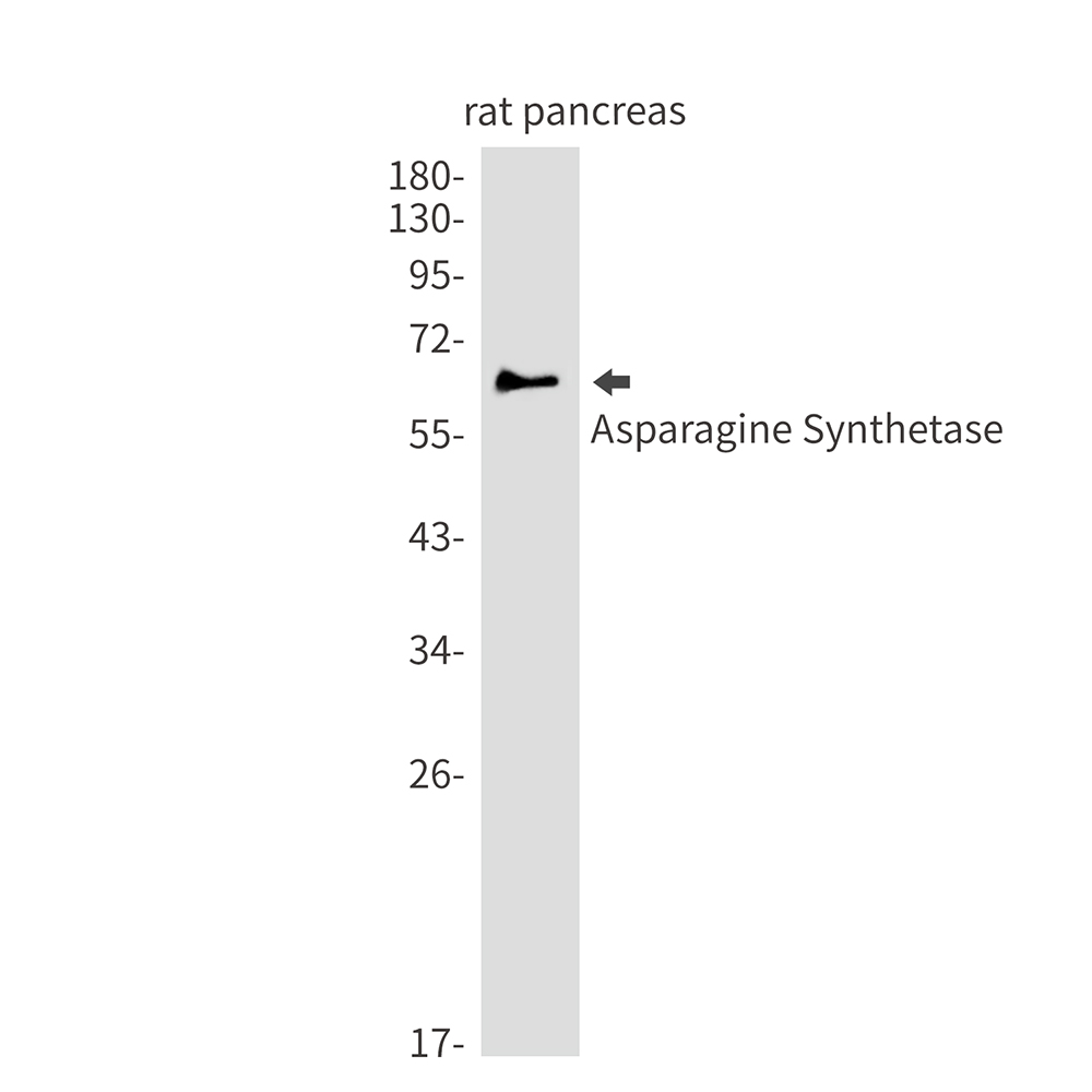 Asparagine Synthetase Rabbit mAb ABZ2774