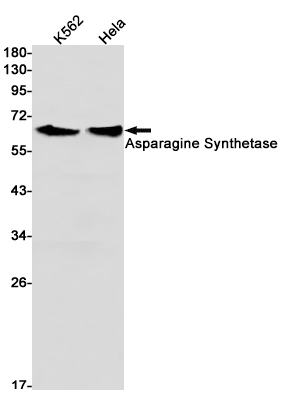 Asparagine Synthetase Rabbit mAb ABZ2774