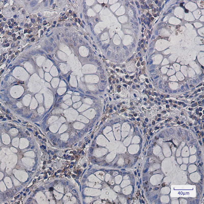 Annexin VI Rabbit mAb ABZ2775