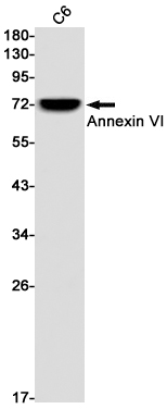 Annexin VI Rabbit mAb ABZ2775