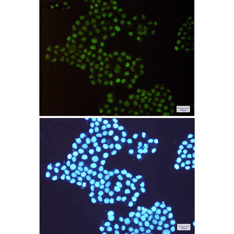 HTF9C/TRMT2A Rabbit mAb ABZ2776