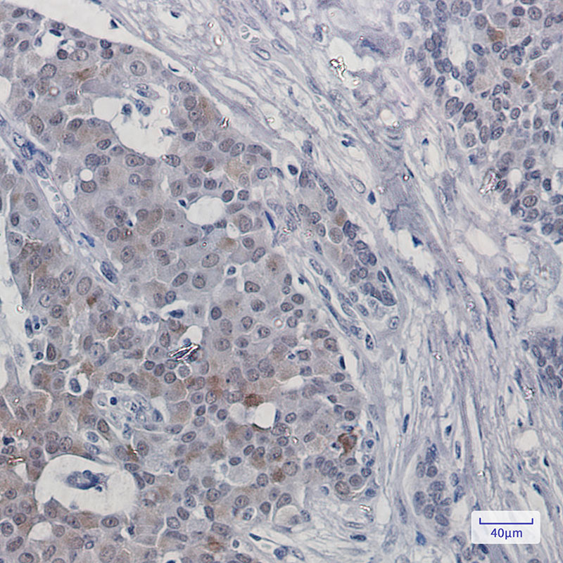 HTF9C/TRMT2A Rabbit mAb ABZ2776