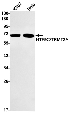 HTF9C/TRMT2A Rabbit mAb ABZ2776