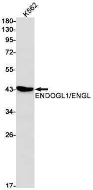 ENDOGL1 Rabbit mAb ABZ2778