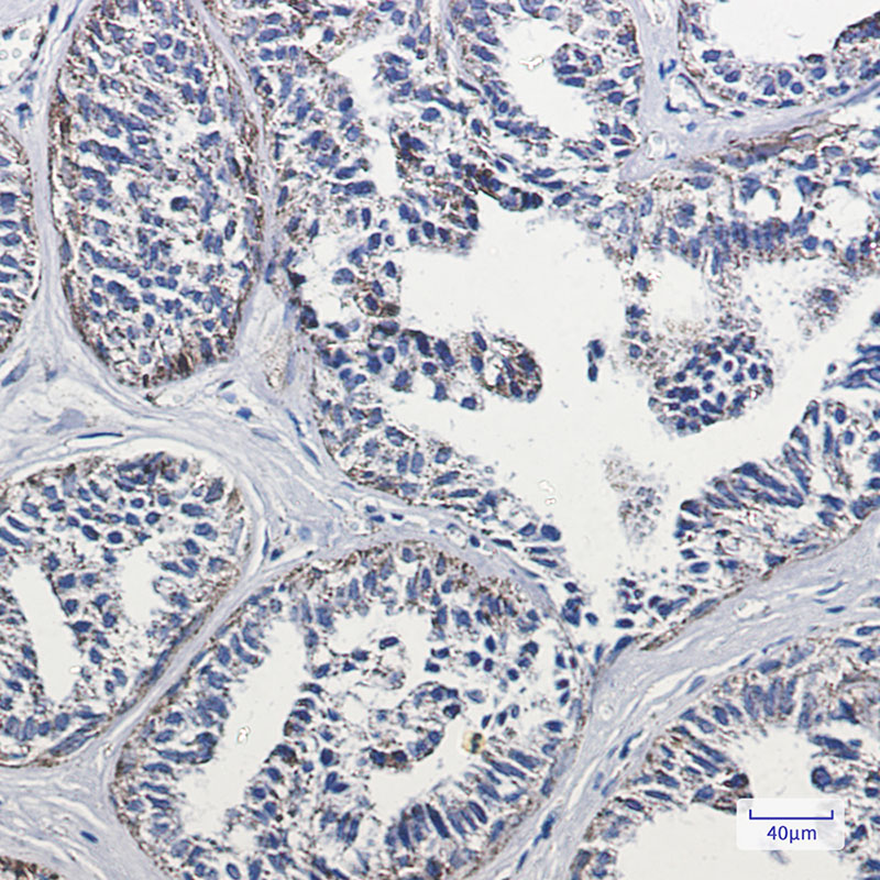 Lipoamide Dehydrogenase Rabbit mAb ABZ2780