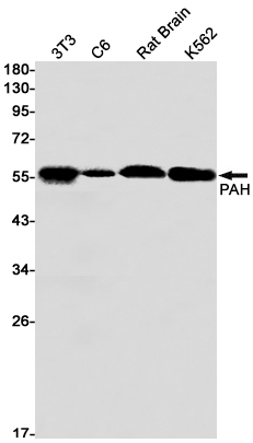 PAH Rabbit mAb ABZ2781
