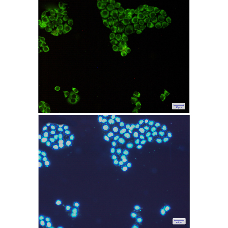 PKR Rabbit mAb ABZ2782