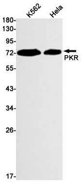 PKR Rabbit mAb ABZ2782