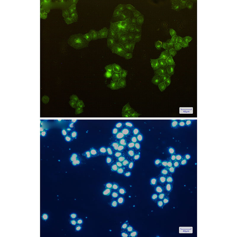 CD13 Rabbit mAb ABZ2784