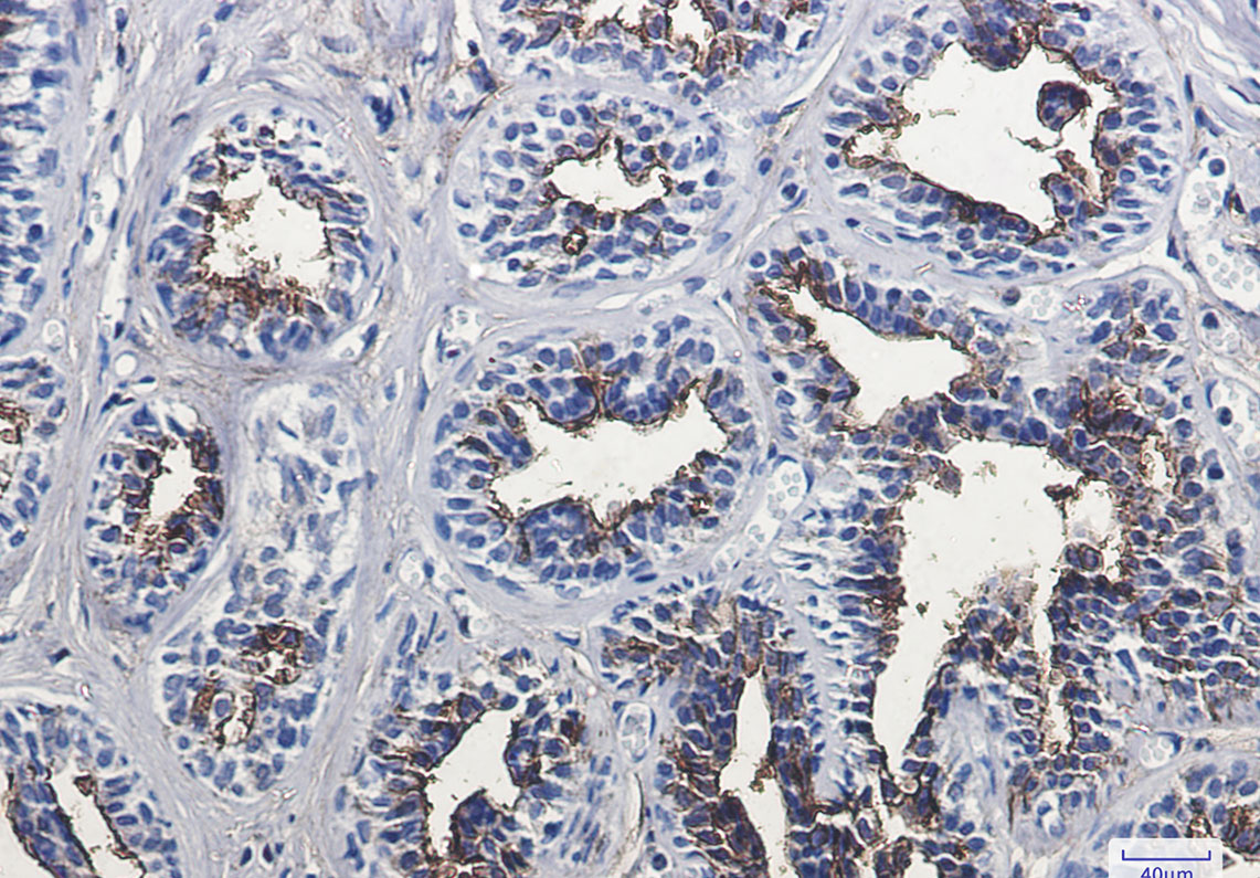 CD13 Rabbit mAb ABZ2784