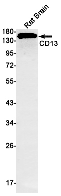 CD13 Rabbit mAb ABZ2784