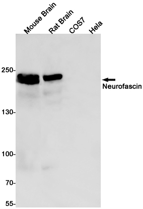 Neurofascin Rabbit mAb ABZ2786