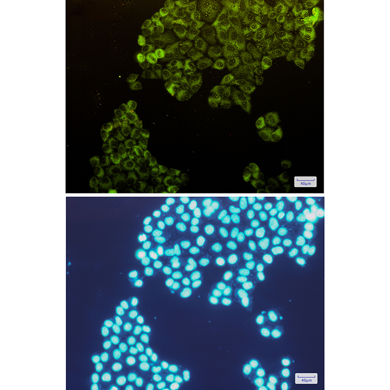 PFKM Rabbit mAb ABZ2787