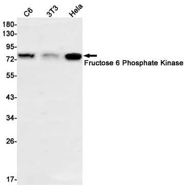 PFKM Rabbit mAb ABZ2787