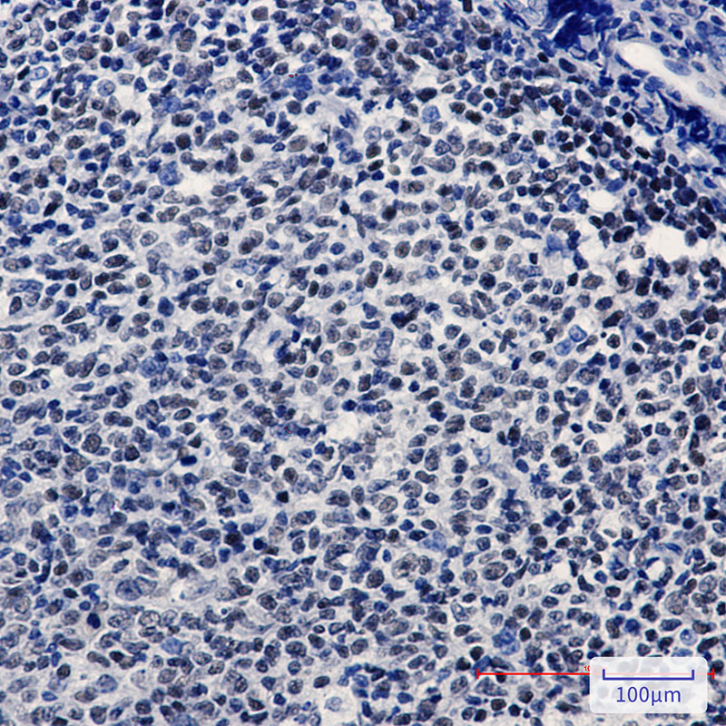 KAT1 Rabbit mAb ABZ2788