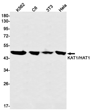 KAT1 Rabbit mAb ABZ2788
