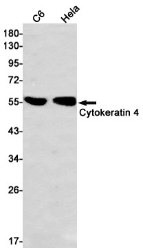 Cytokeratin 4 Rabbit mAb ABZ2789