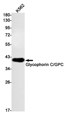 Glycophorin C Rabbit mAb ABZ2790