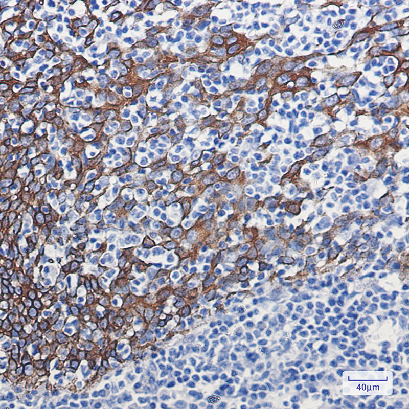 Cytokeratin 16/K16 Rabbit mAb ABZ2791