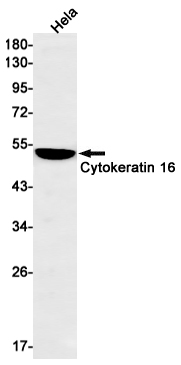 Cytokeratin 16/K16 Rabbit mAb ABZ2791
