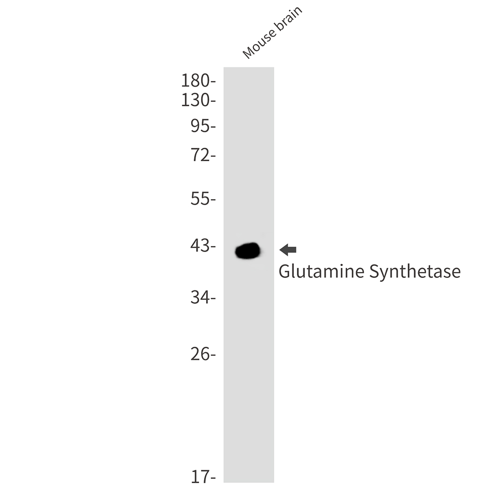 Glutamine Synthetase Rabbit mAb ABZ2792