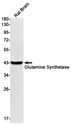 Glutamine Synthetase Rabbit mAb ABZ2792