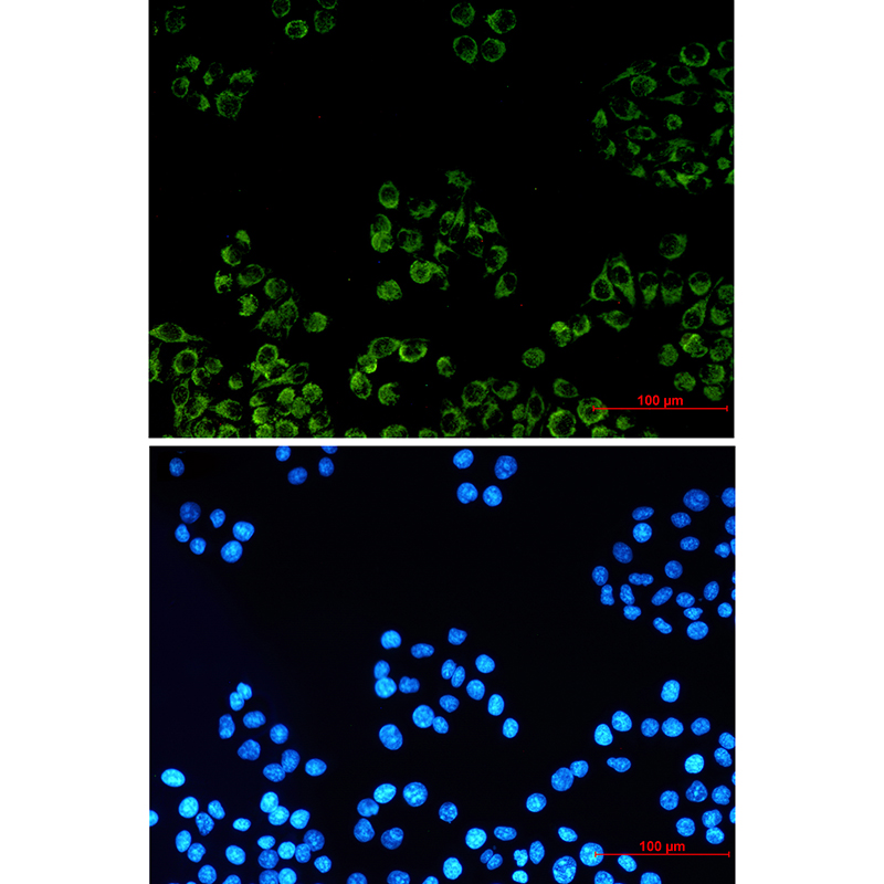 PBR Rabbit mAb ABZ2793