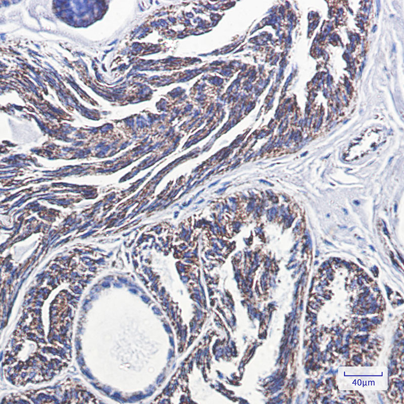 PBR Rabbit mAb ABZ2793