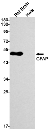 GFAP Rabbit mAb ABZ2794
