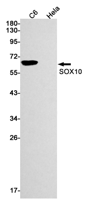 SOX10 Rabbit mAb ABZ2795