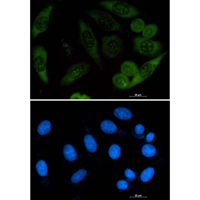 Profilin 1 Rabbit mAb ABZ2796