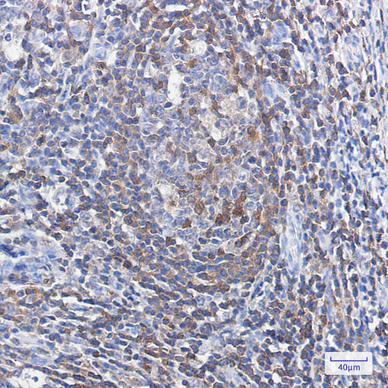 Profilin 1 Rabbit mAb ABZ2796