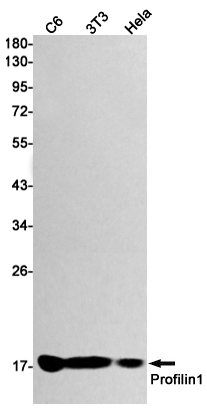 Profilin 1 Rabbit mAb ABZ2796