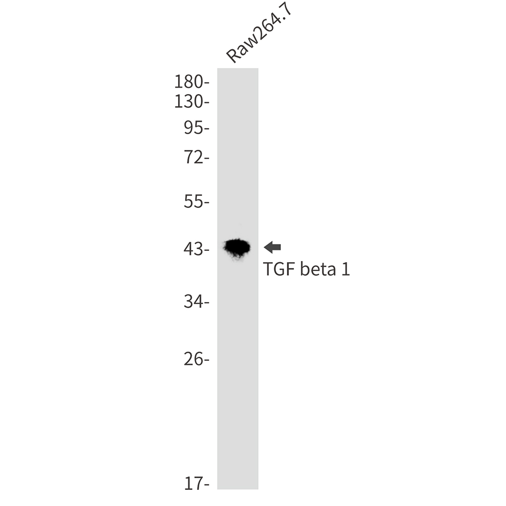 TGF beta 1 Rabbit mAb ABZ2797