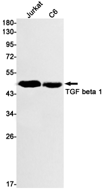TGF beta 1 Rabbit mAb ABZ2797