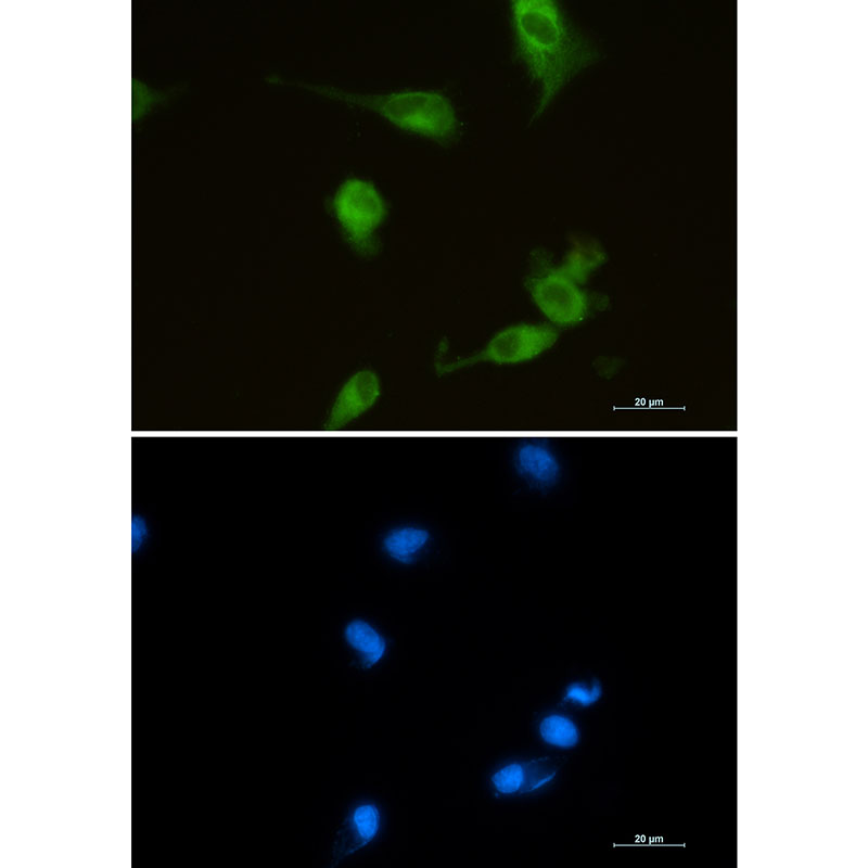 Heme Oxygenase 1 Rabbit mAb ABZ2798