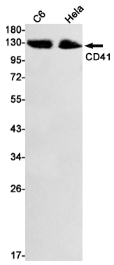 ITGA2B/CD41 Rabbit mAb ABZ2800