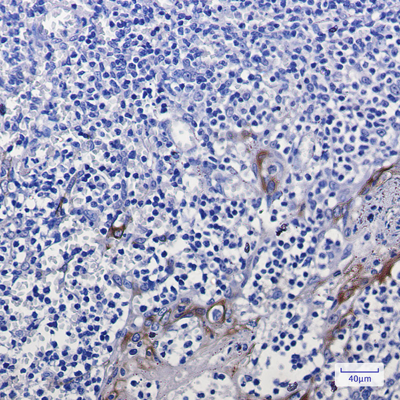 Cytokeratin 10 Rabbit mAb ABZ2802