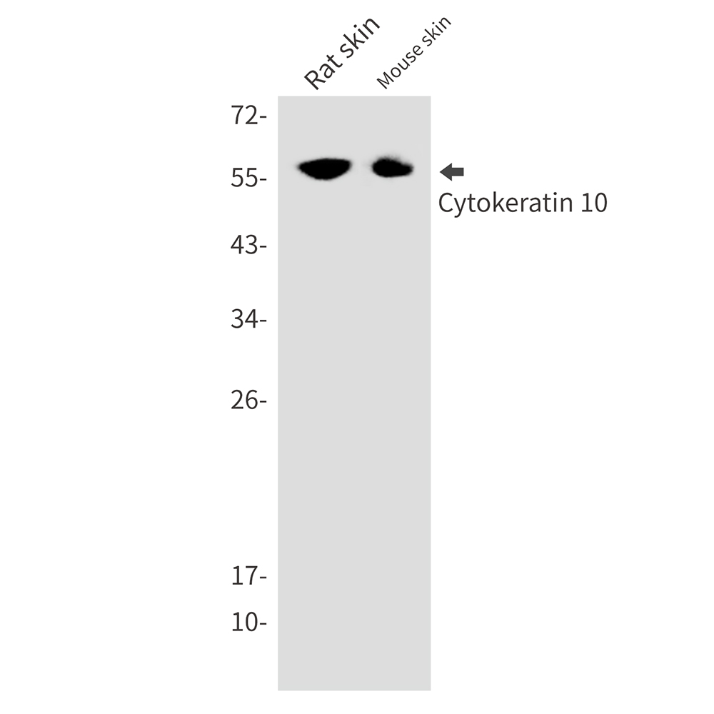 Cytokeratin 10 Rabbit mAb ABZ2802