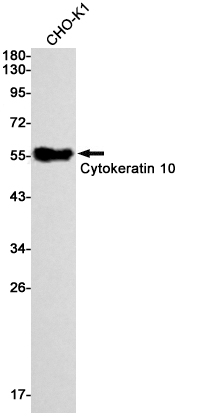 Cytokeratin 10 Rabbit mAb ABZ2802