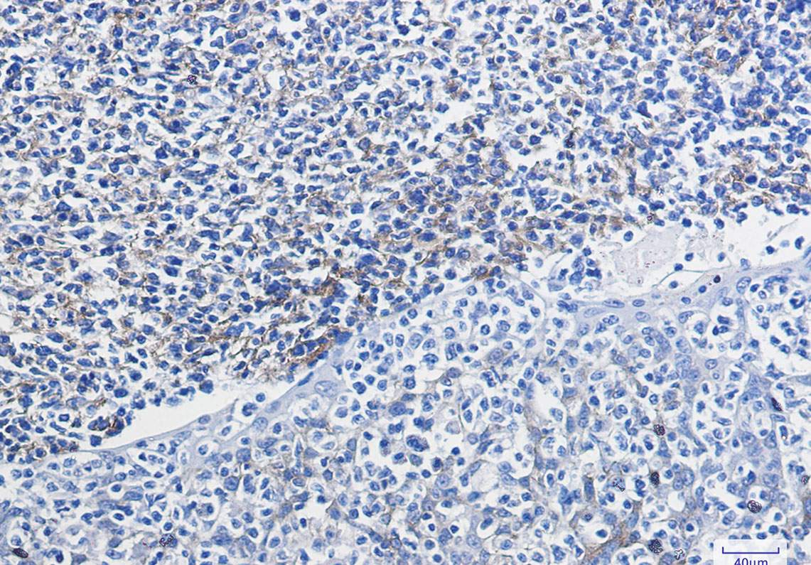 VCAM1 Rabbit mAb ABZ2804