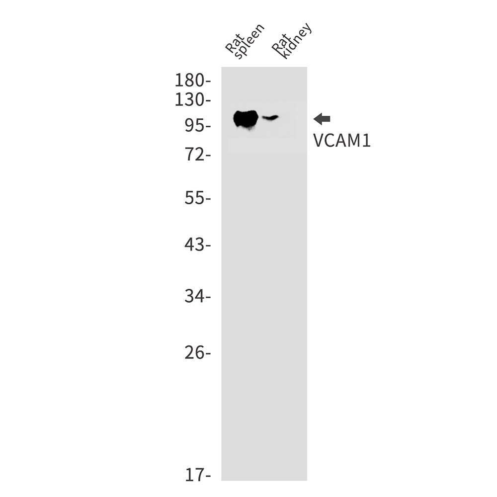 VCAM1 Rabbit mAb ABZ2804