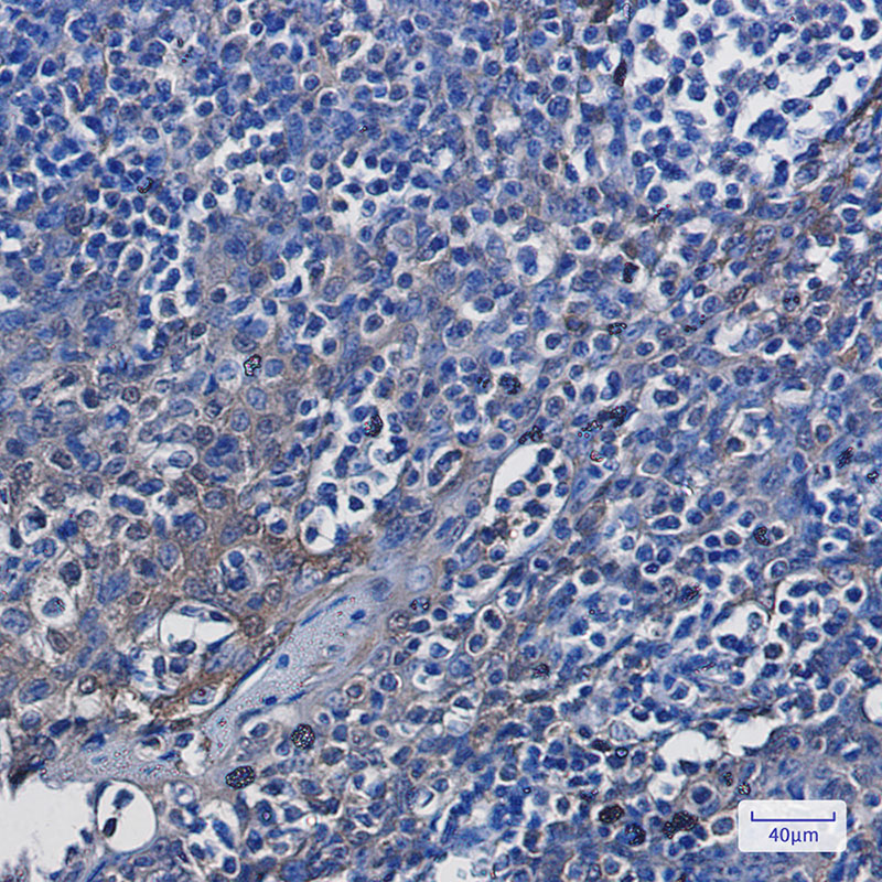 ENO1 Rabbit mAb ABZ2805