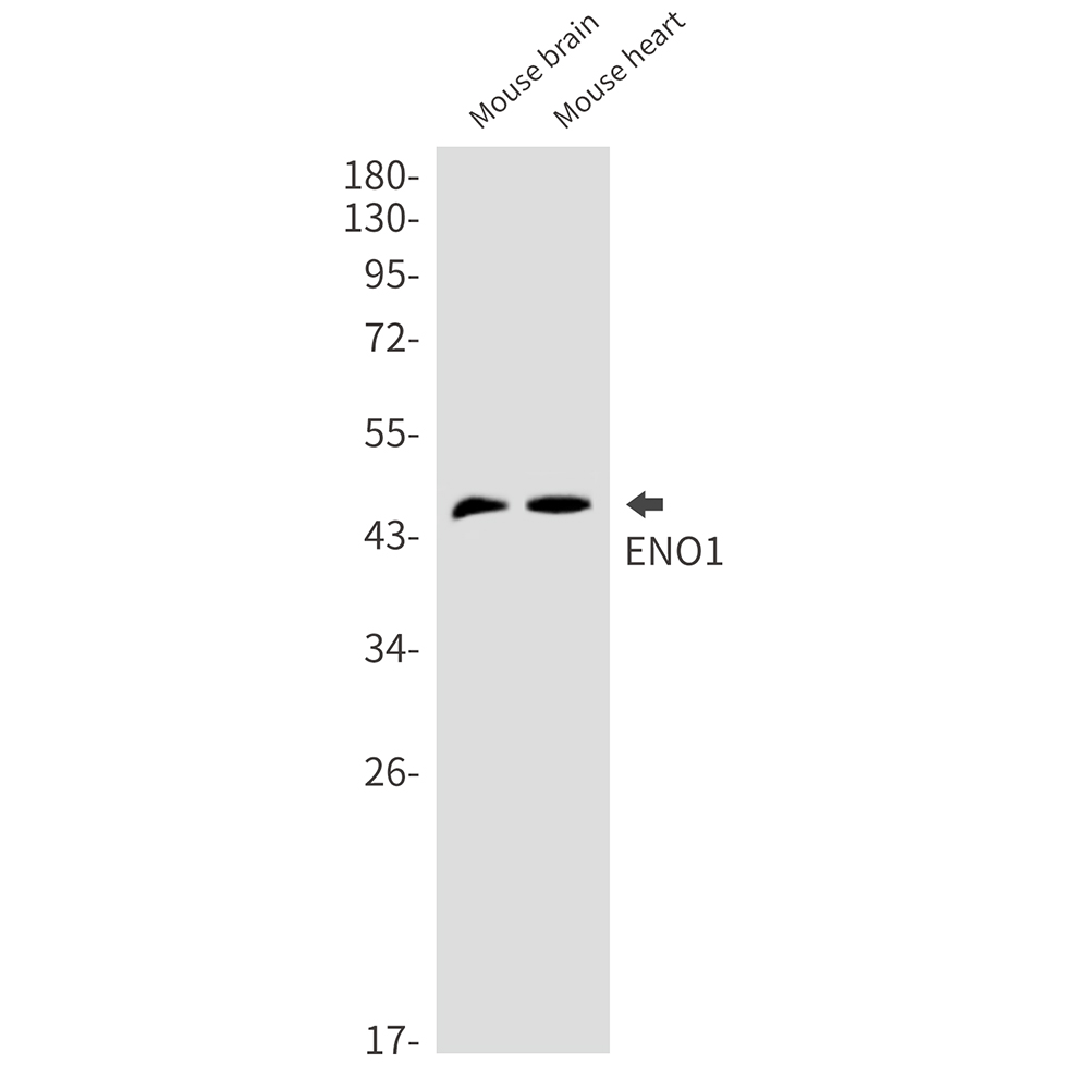 ENO1 Rabbit mAb ABZ2805