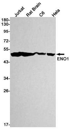 ENO1 Rabbit mAb ABZ2805