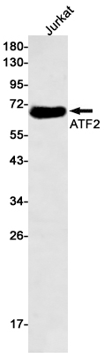 ATF2 Rabbit mAb ABZ2807
