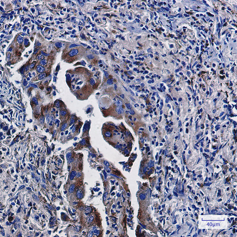 LAMP2 Rabbit mAb ABZ2808